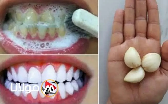 كنز ربانى جبار.. طريقة فعالة لتبيض الأسنان كالؤلؤ وإزالة الجير والإصفرار والرائحة الكريهة في 3 دقائق فقط؟!