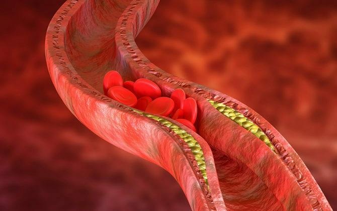 لا يقدر بثمن.. طعام في عشائك يحمي من الجلطات ويخفض الكوليسترول