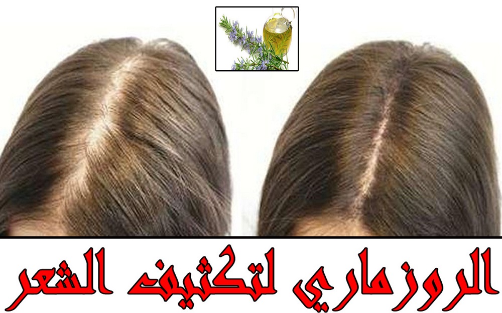 وداعا للشيب المبكر.. طريقة عمل وصفة زيت الروزماري لتطويل الشعر وتنعيمة وتكثيفه في 7 أيام