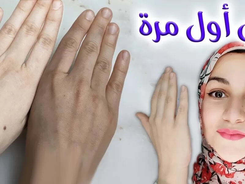 أفضل كريم من الصيدلية لتفتيح البشرة والمناطق الحساسة ضاع عمرك وانتي متعرفيهوش