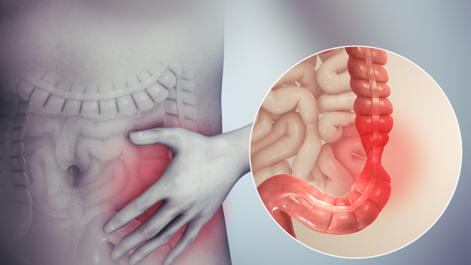 معجزة.. عشبة رخيصة الثمن مفعولها خـارق في معالجة النقرس وآلام المفاصل وانسداد الأمعاء والأرق