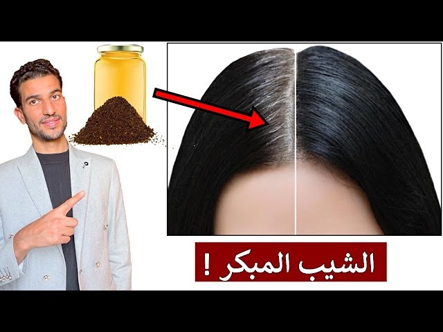 وداعا للشعر الأبيض للابد.. وصفة جبارة للقضاء على الشيب المبكر والشعر الأبيض في 20 دقيقة!