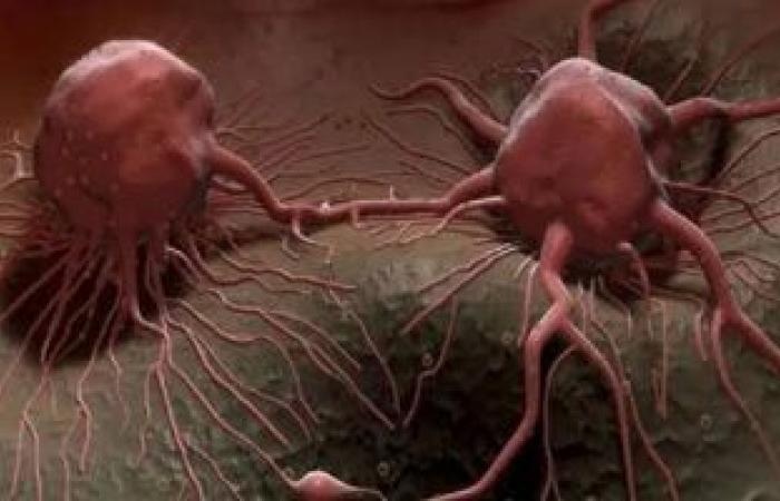 احذر من هذه الاعراض اذا ظهرت فهي تشير على الاصابة بمرض السرطان.. اعرفها الان قبل فوات الاوان