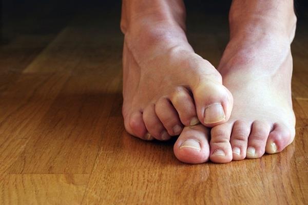 إذهب للطبيب فورا.. علامتان على أظافر القدمين تنذران بالإصابة بـ القاتل الصامت