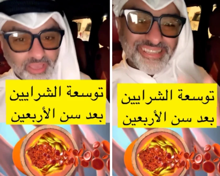 مختص يكشف طرق توسعة الشرايين بعد سن الأربعين (فيديو)