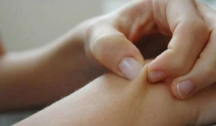 إذا لاحظتها توجه للطبيب فورا.. علامة على الجلد تشير إلى إلاصابة بنوع خبيث من السرطان