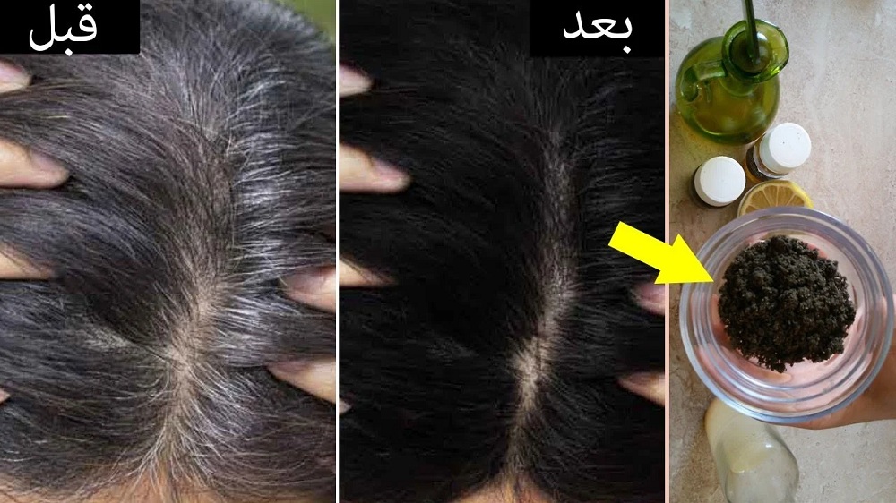 ارجعي لسن الشباب.. وصفة الحلبة للقضاء على الشيب وكافة مشاكل شعرك نتيجتها جبارة