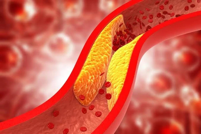 خبراء يكشفون عن نوع من الكربوهيدرات يعزز صحة القلب ويقى من ارتفاع الكوليسترول