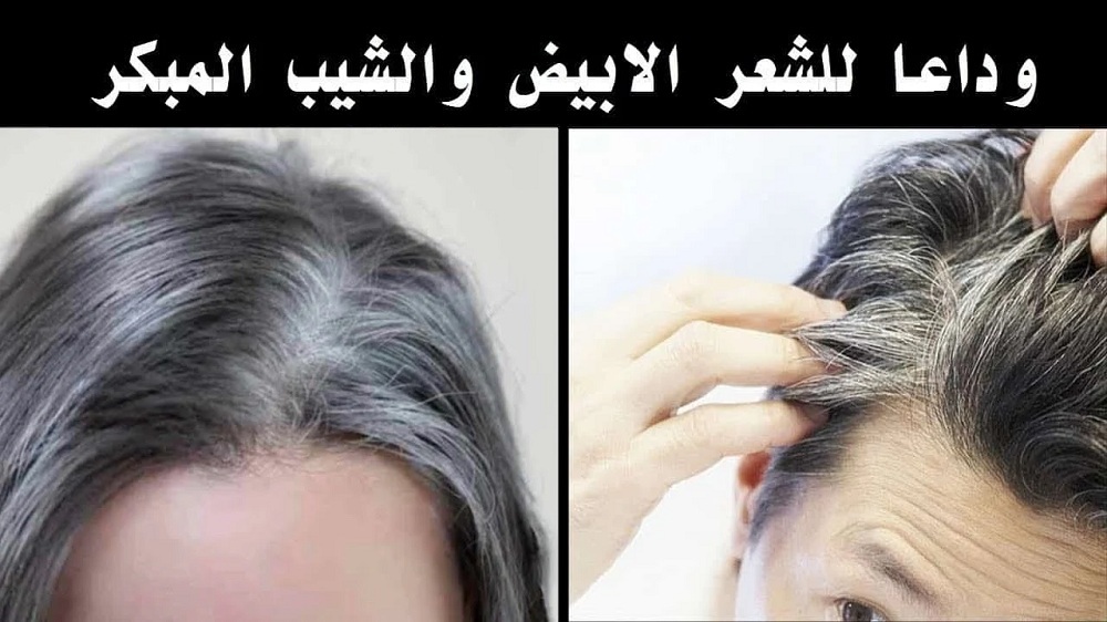 وداعا للشيب المبكر.. بدون حنة ولا صبغة وصفة سحرية للقضاء على الشيب نهائياً هترجعك عروسة تاني!